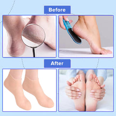 Silicone Moisturizing Gel Socks Exfoliating Heel Protection Socks For Dry Cracked Feet Heel – 1 Pair