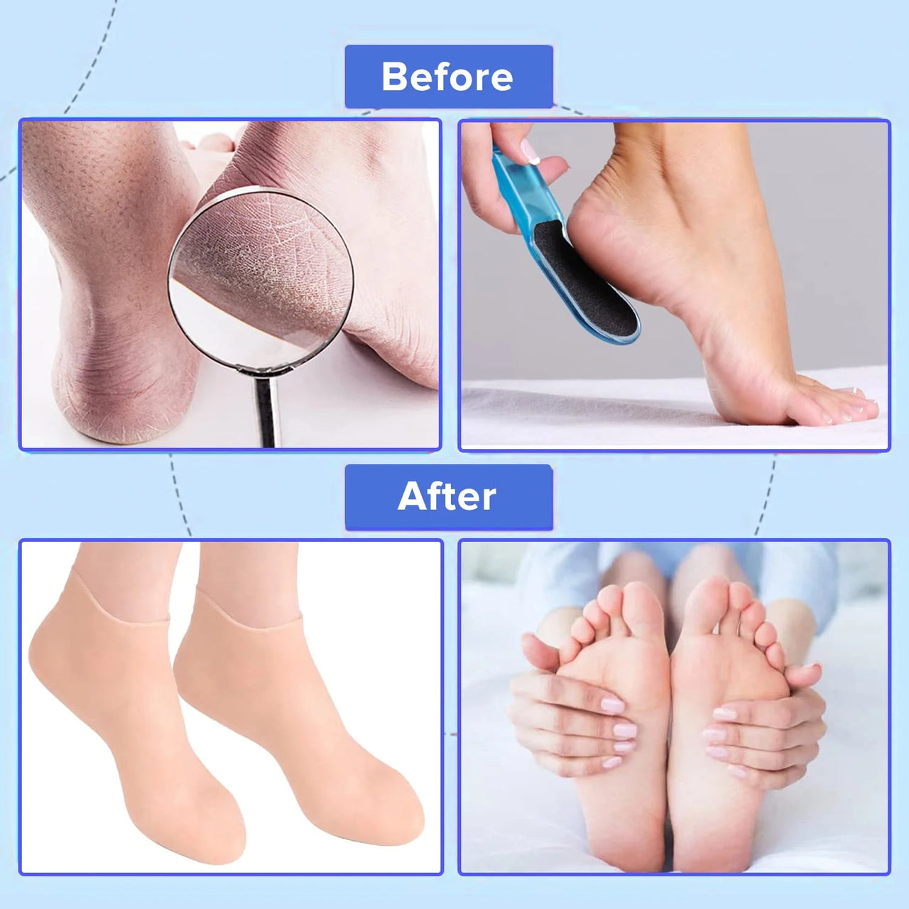 Silicone Moisturizing Gel Socks Exfoliating Heel Protection Socks For Dry Cracked Feet Heel – 1 Pair